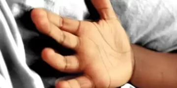 फूड प्वाइजनिंग