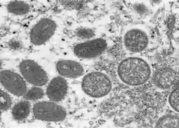 मंकीपाक्स