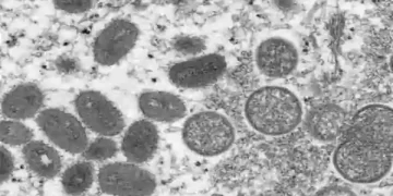 मंकीपाक्स