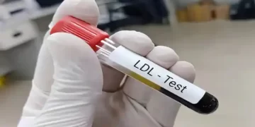 Cholesterol