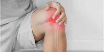 Arthritis