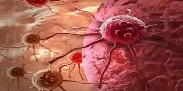 Cancer