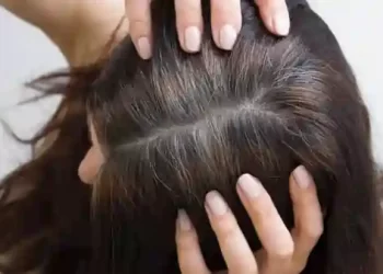 सफेद बालों