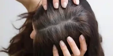 सफेद बालों