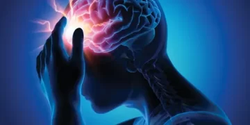 Brain Stroke