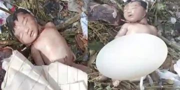 Newborn Baby Corpse
