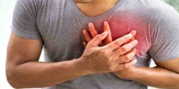 Cardiac Arrest