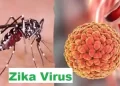 Zika Virus