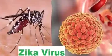 Zika Virus