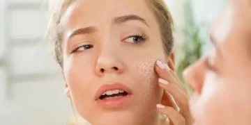 Dry Skin