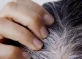 White Hair