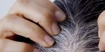 White Hair