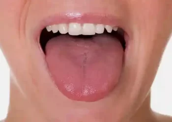 Tongue