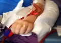 Kidney