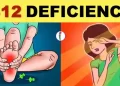 Vitamin B12 deficiency