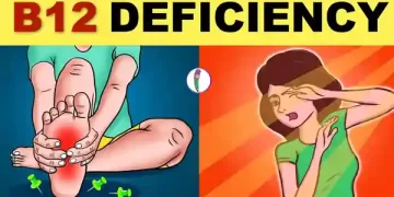 Vitamin B12 deficiency