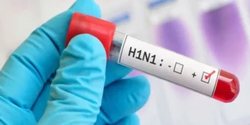H1N1 Virus